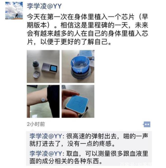 YY创始人李学凌自曝体内植入芯片